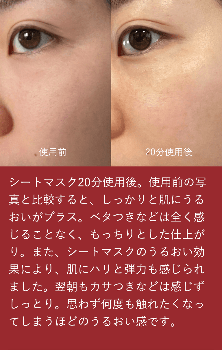 シートマスク20分使用後。使用前の写真と比較すると、しっかりと肌にうるおいがプラス。ベタつきなどは全く感じることなく、もっちりとした仕上がり。また、シートマスクのうるおい効果により、肌にハリと弾力も感じられました。翌朝もカサつきなどは感じずしっとり。思わず何度も触れたくなってしまうほどのうるおい感です。