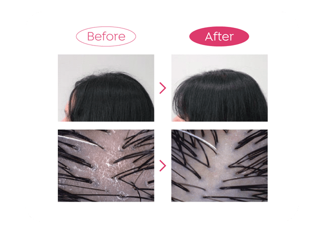 アピュー ラズベリー ヘアビネガートリートメント